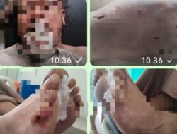 Nico Saragih Jurnalis Media Online Medan Ditemukan Tewas, Diduga Korban Pembunuhan